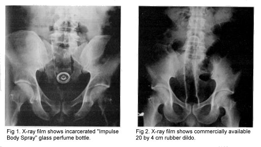 xrays 29K jpg